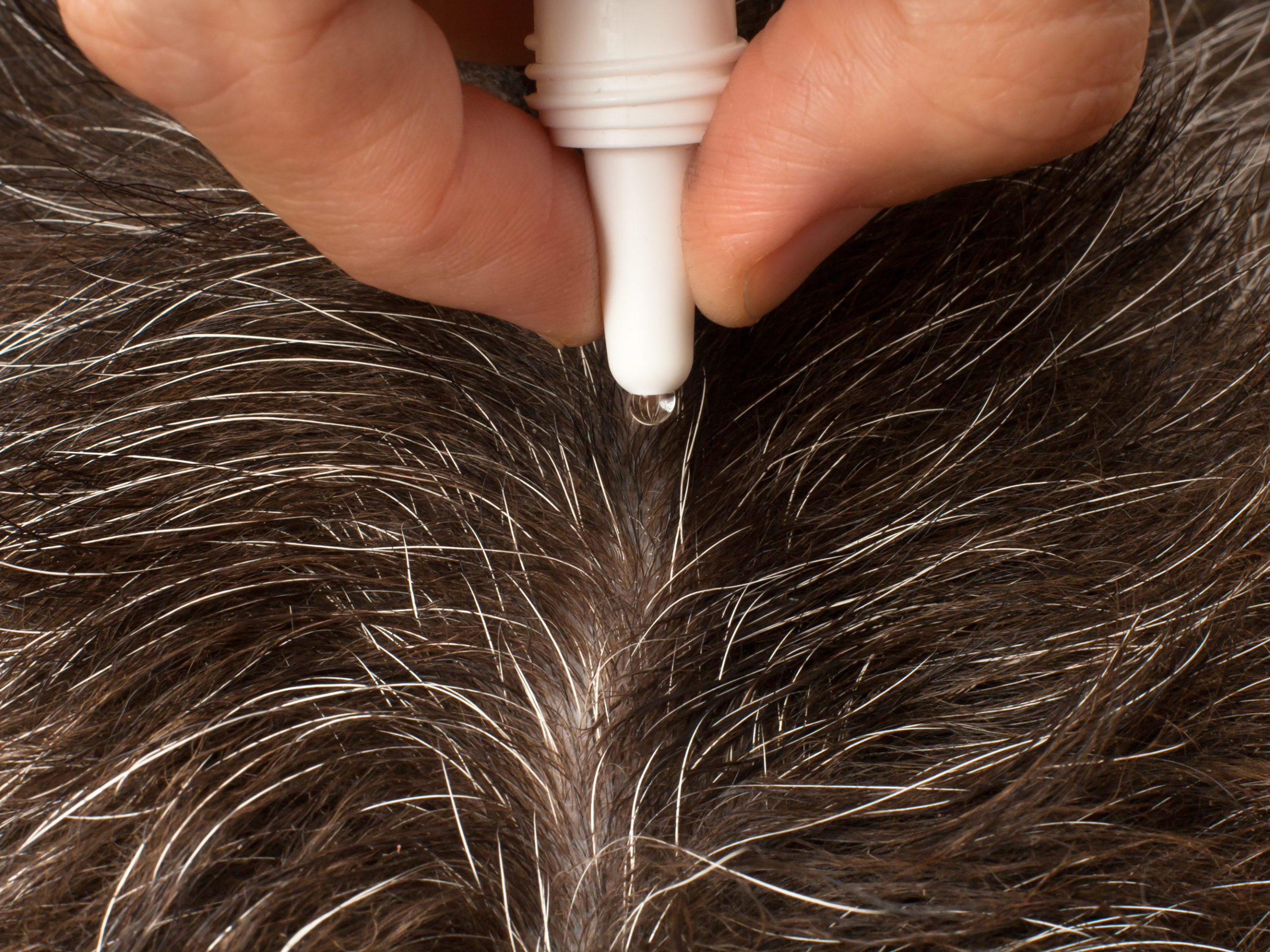 flea treatment is the most common way to prevent fleas